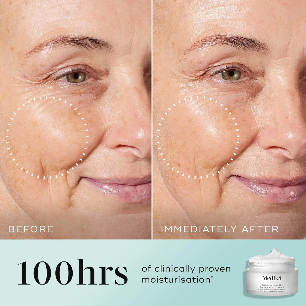 Total Moisture Daily Facial Cream - Refill
